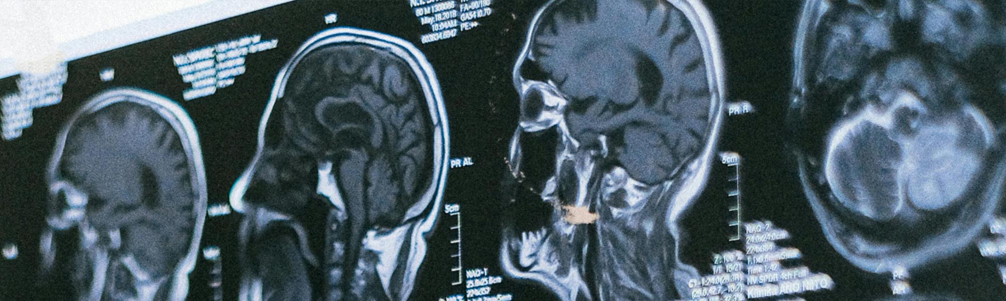 Photo by Anna Shvets: https://www.pexels.com/photo/finger-pointing-to-a-brain-scan-4226119/