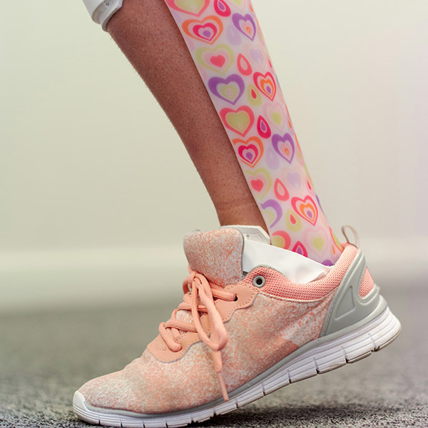 A colorful pink prosthetic