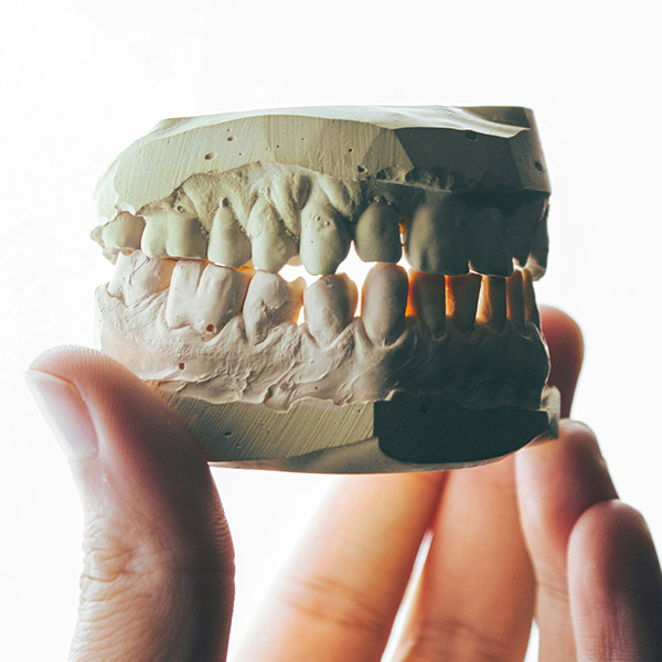 a mold of teeth-